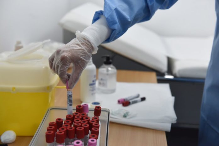CORONAVIRUS, TEST SIEROLOGICI ALL'UNIVERSITA' BICOCCA