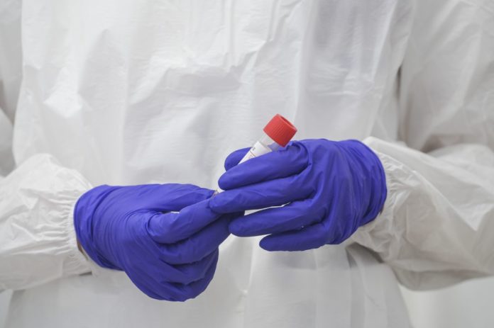 UNIVERSITA' LA SAPIENZA, TAMPONI MOLECOLARI SARS-COV-2 GRATUITI PER GLI STUDENTI