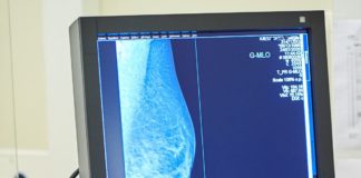 Tumore al seno, Europa Donna “Test genomici non ancora rimborsati”