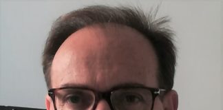 Al Policlinico Bari ricostruita valvola aortica con tecnica innovativa