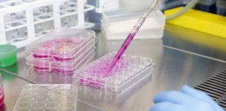 Parkinson, dallo studio di una forma ereditaria una possibile terapia