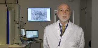 Alzheimer, alterazioni attività del cervello durante sonno e veglia