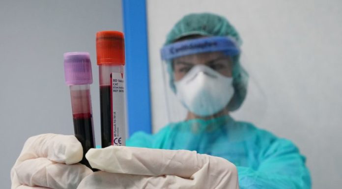 Coronavirus, 8.292 nuovi casi e 139 decessi nelle ultime 24 ore