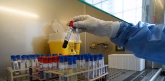 Uno studio, anticorpi contro il Covid per almeno 8 mesi dall’infezione