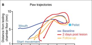 Riabilitazione post-ictus, nuovo approccio tra robotica e serotonina