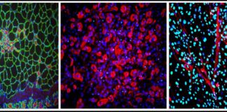 Nuovo meccanismo molecolare contro la degenerazione muscolare