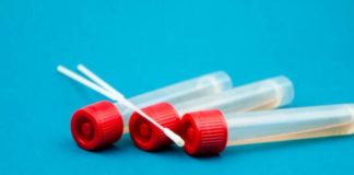 Covid, in Piemonte 191 nuovi casi e 2 decessi