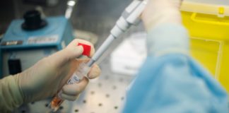 Covid, le allergie non un fattore di rischio per le forme più severe