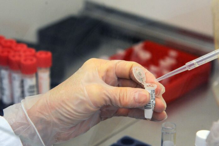 AZIENDA OSPEDALIERA POLICLINICO LABORATORIO TAMPONI COVID 19