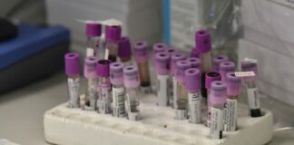 Covid, dalla Commissione Ue 120 milioni per 11 progetti di ricerca