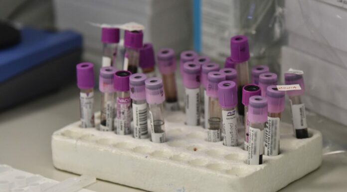 Covid, dalla Commissione Ue 120 milioni per 11 progetti di ricerca