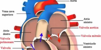 Insufficienza mitralica, italiano studio multicentrico più ampio