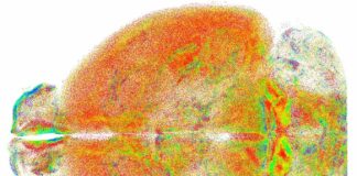 Nuova tecnica ottica per lo studio del cervello