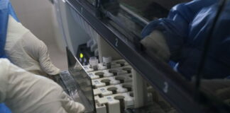 Covid, studio su anticorpi monoclonali tetravalenti contro il virus