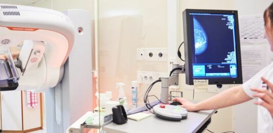 In Lombardia screening per il tumore al seno al 60,5%, superato lo standard nazionale