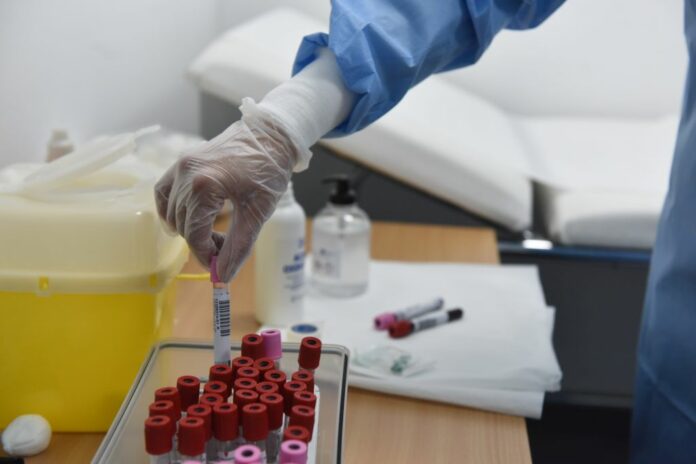 CORONAVIRUS, TEST SIEROLOGICI ALL'UNIVERSITA' BICOCCA