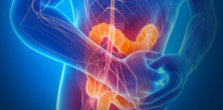 Al Gemelli Pca per pazienti con infiammazione cronica intestinale