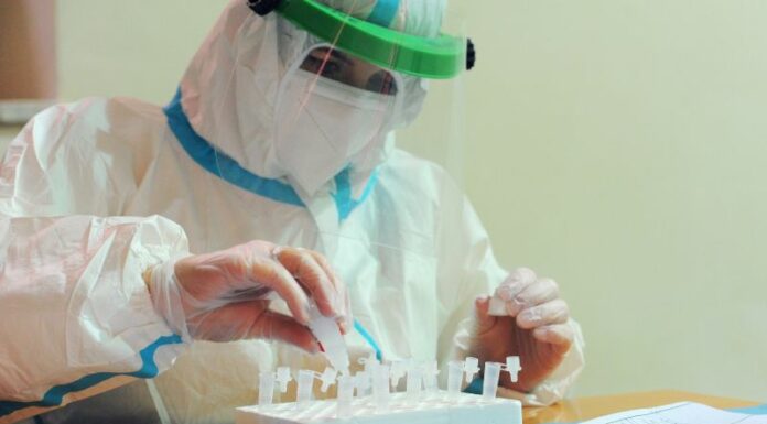 Covid, 7.188 nuovi positivi e 34 decessi nelle ultime 24 ore