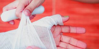 Ogni anno in Italia si verificano circa 100mila ustioni