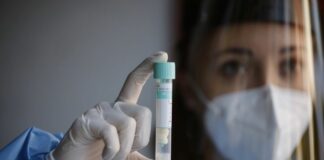 Covid, 4.021 nuovi casi 72 decessi e tasso positività a 1,26%