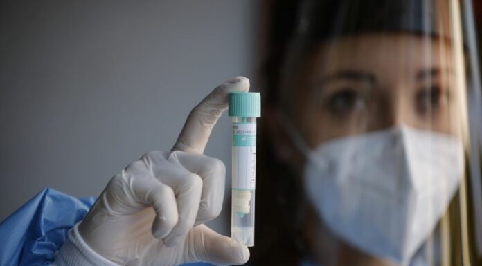 Covid, 2.437 nuovi casi e 24 decessi nelle ultime 24 ore