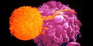 Tumori della pelle, nuova luce sui processi molecolari