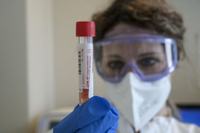 CAMPUS BIO MEDICO LABORATORIO TAMPONI COVID-19