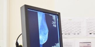 Tumore al seno, Umbria regione virtuosa ma serve una cabina di regia