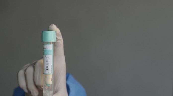 Covid, sale l’incidenza settimanale