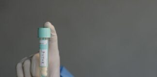 Covid, sale l’incidenza settimanale