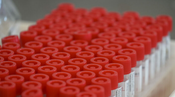 Covid, Omicron: paziente campano è atterrato a Fiumicino. Poi a Milano