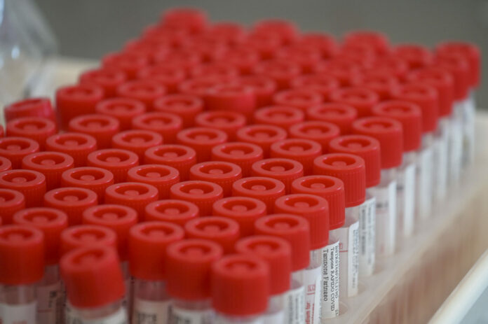 CAMPUS BIO MEDICO LABORATORIO TAMPONI COVID-19