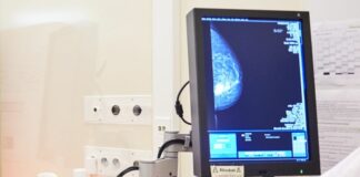 Carcinoma mammario, risultati positivi studio Emerald su Elacestrant