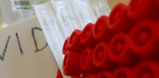 Covid, in Abruzzo 921 nuovi casi e 3 decessi in 24 ore