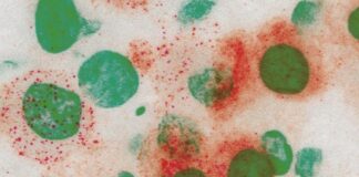 Covid, scoperto un nuovo meccanismo di resistenza immunitaria