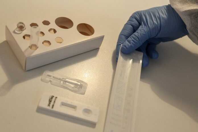 CORONAVIRUS, AL VIA I TEST RAPIDI NELLA FARMACIA IGEA DI ROMA