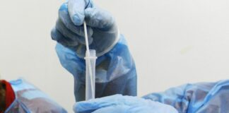 Covid, 93.157 nuovi casi e 375 decessi nelle ultime 24 ore