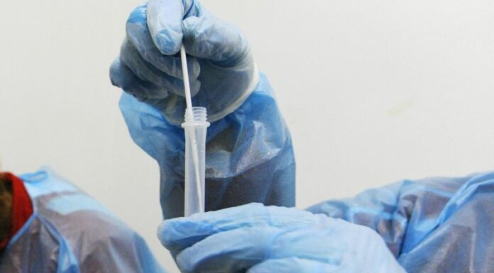 Covid, 93.157 nuovi casi e 375 decessi nelle ultime 24 ore