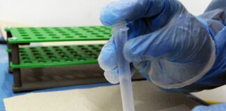 Covid, 75.862 nuovi casi e 325 decessi in 24 ore