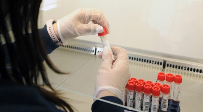 Covid, il 31 gennaio la variante Omicron nel 99,1% dei campioni