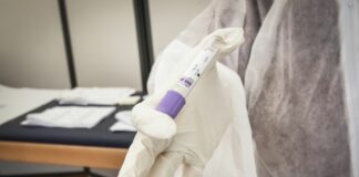 Covid, Salmassi: “Più contagi per effetto delle minori restrizioni”