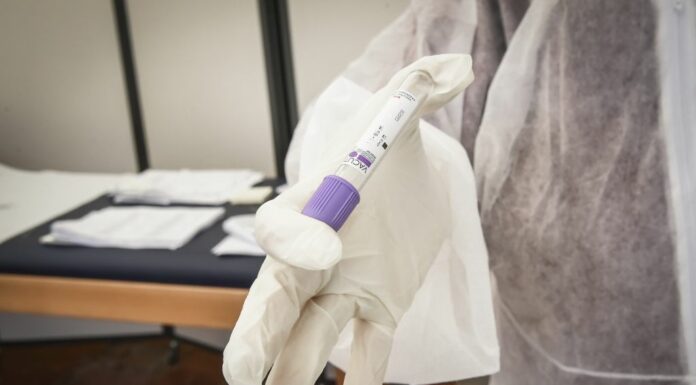 Covid, Salmassi: “Più contagi per effetto delle minori restrizioni”