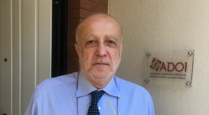 Sos psoriasi, dermatologi ADOI istituiscono numero verde per i pazienti