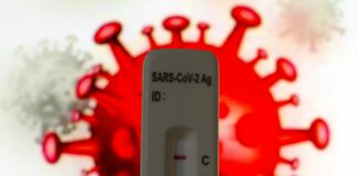 Covid, 53.602 nuovi casi e 130 decessi nelle ultime 24 ore