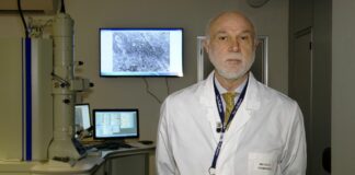 L’intelligenza artificiale per prevedere chi si ammalerà di Demenza