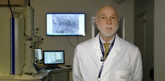 Intelligenza artificiale arma per prevedere chi si ammalerà di demenza