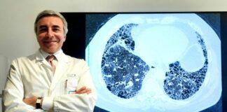 Fibrosi Polmonare Idiopatica, sul Nejm risultati studio Unicatt-Gemelli