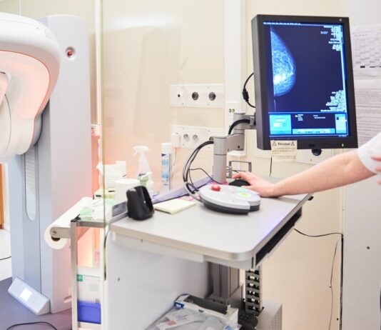 Tumore al seno, Aifa approva ribociclib per ridurre il rischio della recidiva