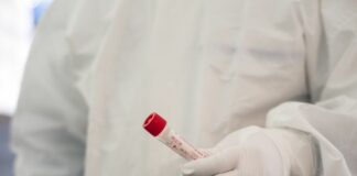 Report Altems, dimezzato il numero di nuovi casi Covid nell’ultimo mese