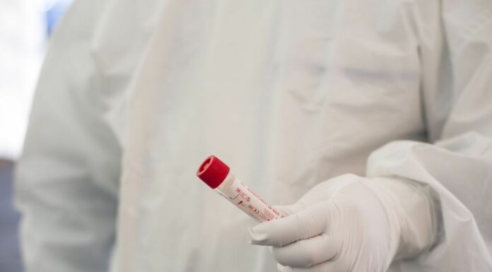 Covid, in Italia 84.700 casi e 63 decessi nelle ultime 24 ore